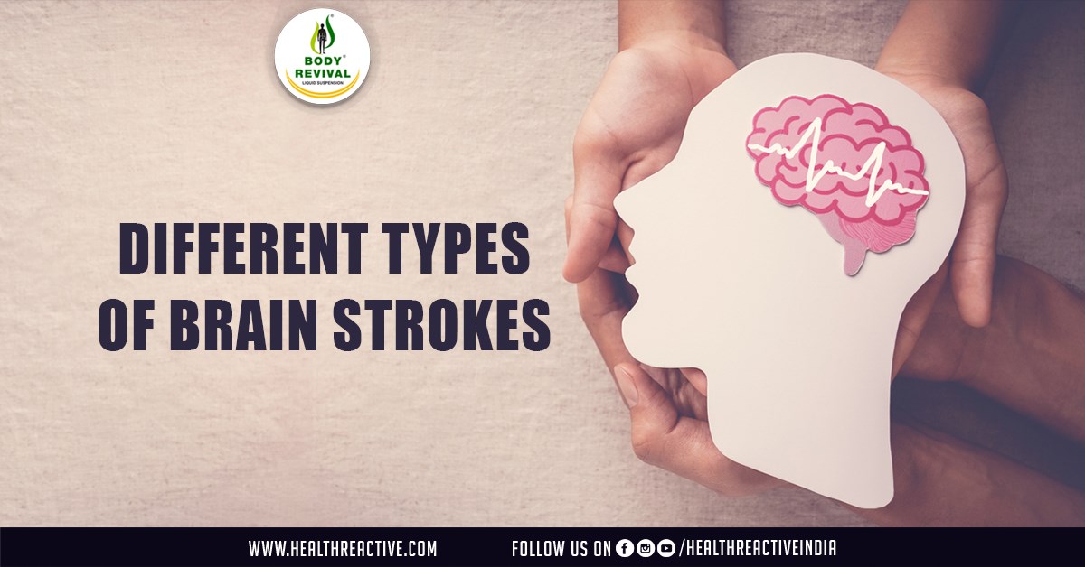Understanding the Different Types of Brain Strokes