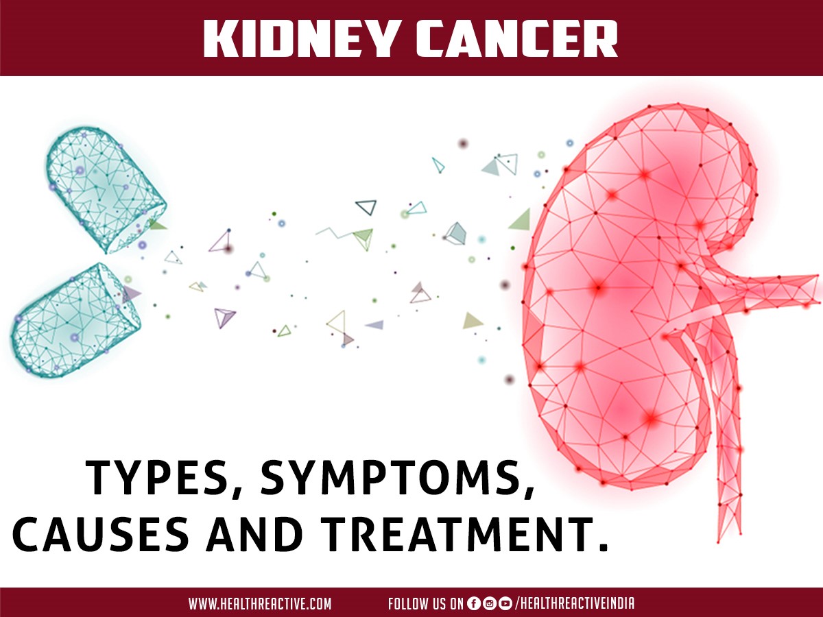 Kidney Cancer
