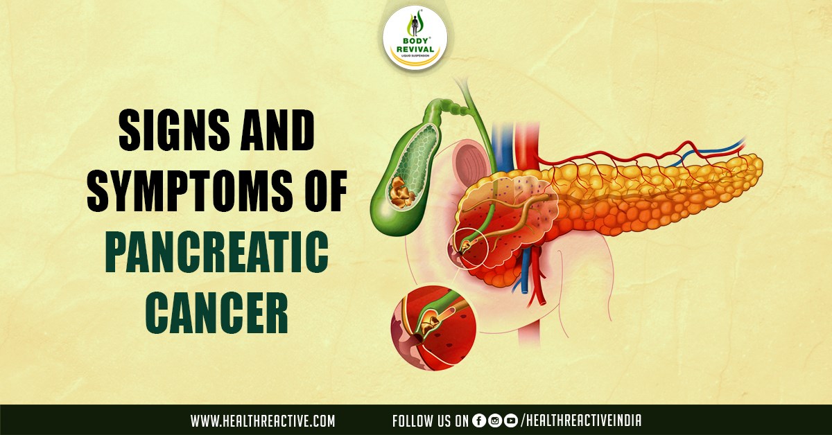 Unveiling the Silent Threat: Signs and Symptoms of Pancreatic Cancer