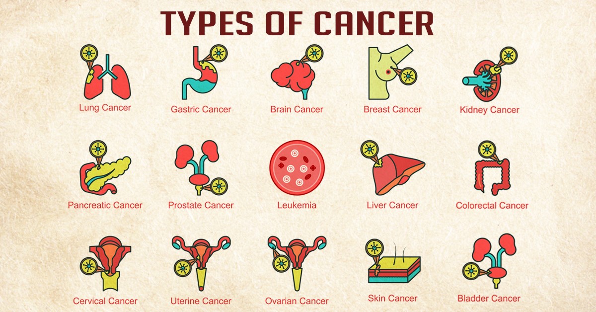 Types Of Cancer Symptoms Causes And Treatment Health Reactive Body