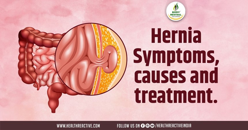 Understanding Strangulated Hernia: Causes, Symptoms, and Treatment