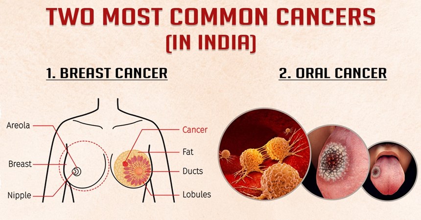 The 2 Most Common Cancer in India.