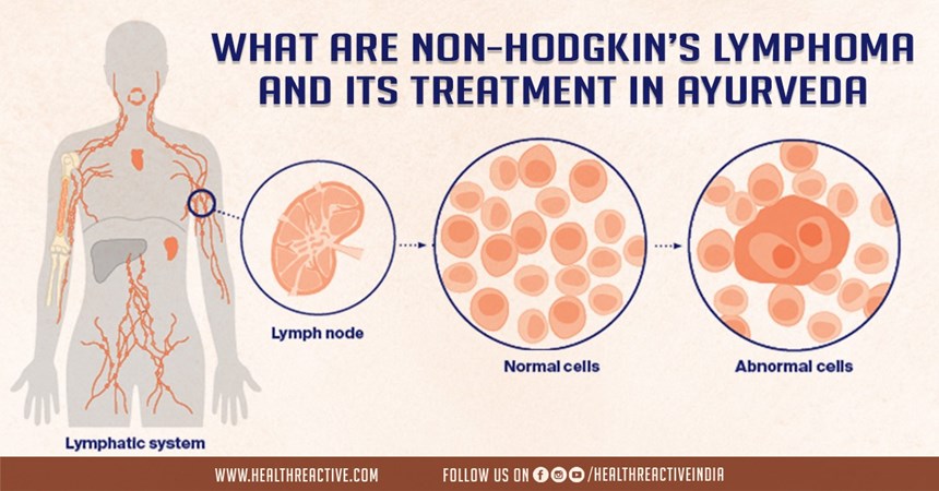 What are non-Hodgkin’s lymphoma and Its treatment in Ayurveda