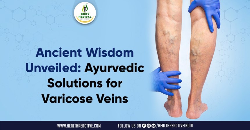 Ancient Wisdom Unveiled: Ayurvedic Solutions for Varicose Veins