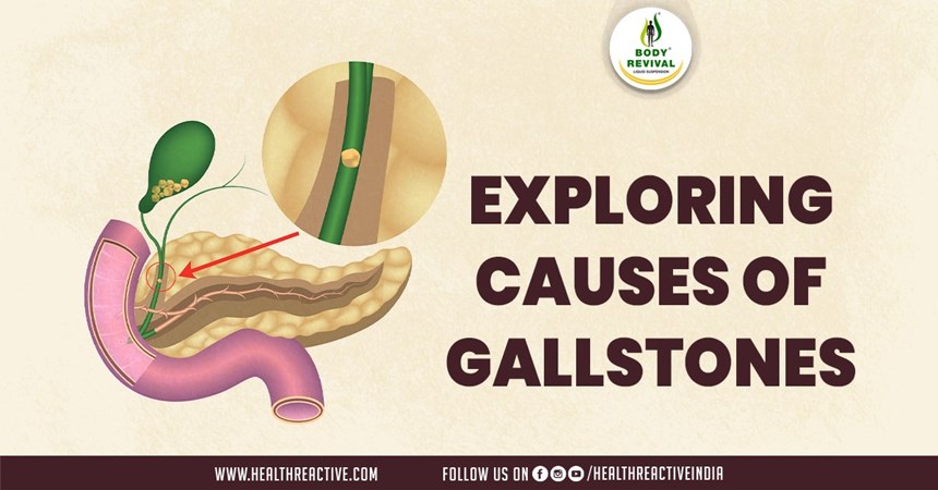 Unraveling the Mystery: Exploring the Causes of Gallstones