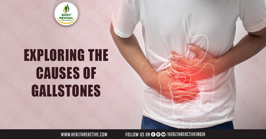 Exploring the Causes of Gallstones