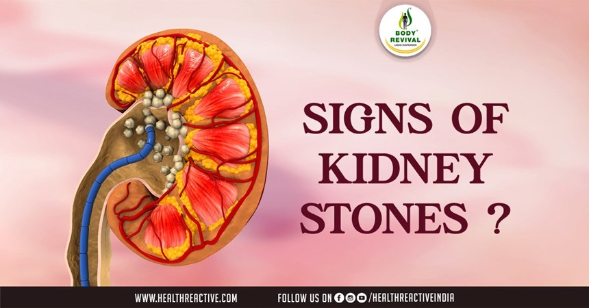 Understanding the Signs: Early Detection of Kidney Stones