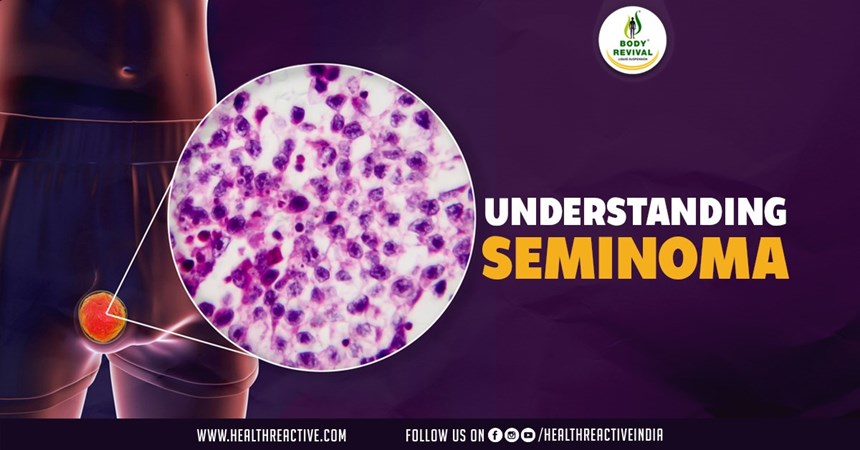 Understanding Seminoma: A Comprehensive Overview