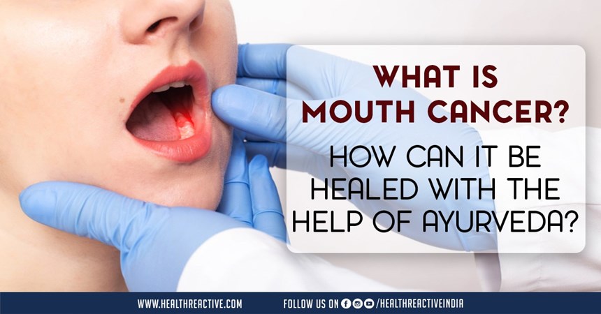 What is mouth cancer? How can it be healed with the help of Ayurveda?